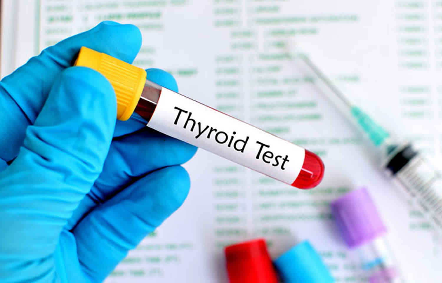 Thyroid Function Test (TFT)